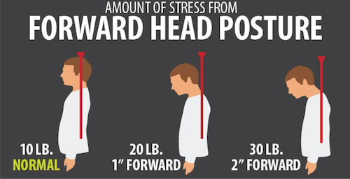 forward-head-posture